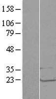 NBL1-12720 - LSM1 Lysate