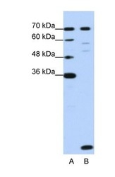 NBP1-57504 - LSM2
