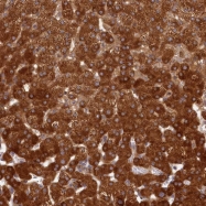 NBP1-82474 - Lanosterol synthase