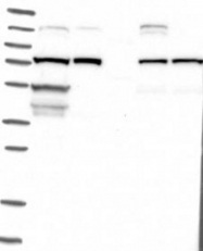 NBP1-82474 - Lanosterol synthase
