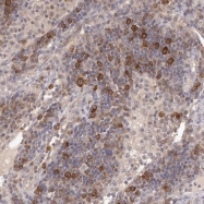 NBP1-86734 - LTV1