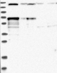 NBP1-86733 - LTV1