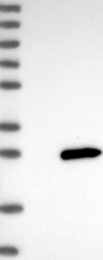 NBP1-80794 - LYG1