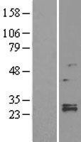 NBL1-12760 - LYPLA1 Lysate