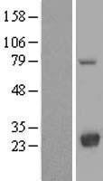 NBL1-12761 - LYPLA2 Lysate