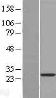 NBL1-12763 - LYPLAL1 Lysate