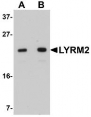 NBP1-77137 - LYRM2