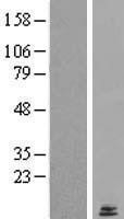NBL1-12765 - LYRM2 Lysate