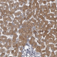 NBP1-81095 - LYSMD1