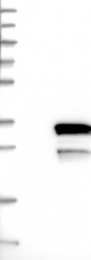 NBP1-81095 - LYSMD1