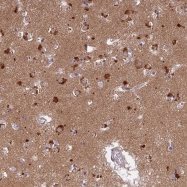 NBP1-82702 - LYSMD2
