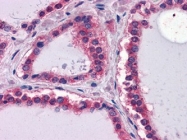NBP1-51558 - Laminin beta-1 / LAMB1