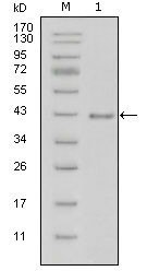 NBP1-51558 - Laminin beta-1 / LAMB1