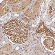 NBP1-87717 - Laminin beta-2
