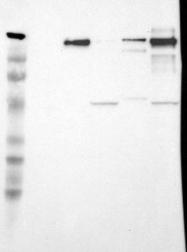 NBP1-87717 - Laminin beta-2