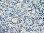 NBP1-47829 - LTA4H