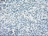 NBP1-47829 - LTA4H