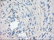 NBP1-47829 - LTA4H
