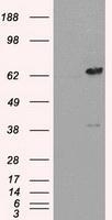 NBP1-47829 - LTA4H