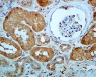 NBP1-95835 - LTA4H