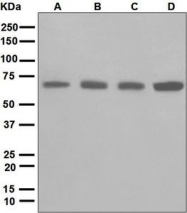 NBP1-95835 - LTA4H