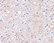 NBP1-77320 - LGI1 / EPT