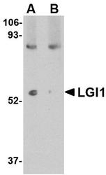 NBP1-76379 - LGI1 / EPT