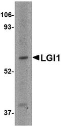 NBP1-77320 - LGI1 / EPT