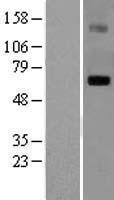 NBL1-12506 - Lgi1 Lysate
