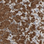 NBP1-89631 - LSR / LISCH