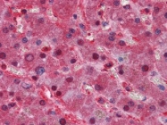 NBP1-51563 - Apolipoprotein(a) / LP(a)