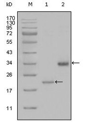 NBP1-51563 - Apolipoprotein(a) / LP(a)