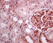 NBP1-96021 - Apolipoprotein(a) / LP(a)