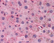 NBP1-39589 - Apolipoprotein(a) / LP(a)