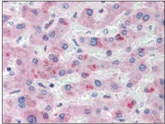NBP1-50603 - Apolipoprotein(a) / LP(a)