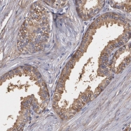 NBP1-87726 - Lumican