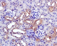 NBP1-95369 - Ly6A/E / SCA1