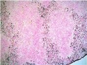 NB600-1387 - Ly6G / GR1 Neutrophil Marker