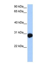 NBP1-62353 - SLAMF6