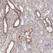 NBP1-92092 - KRCC1 / CHBP2