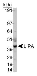 NBP1-54155 - LIPA