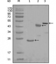NBP1-47417 - KARS