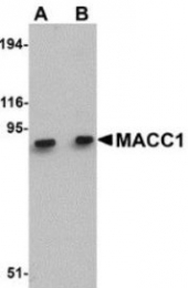 NBP1-77968 - WNT10B