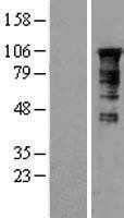 NBL1-12825 - MAGT1 Lysate