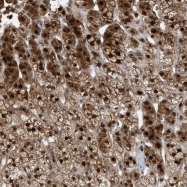 NBP1-90032 - NAA35 / MAK10