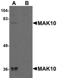 NBP1-77056 - NAA35 / MAK10