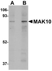 NBP1-77057 - NAA35 / MAK10