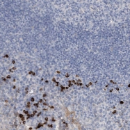 NBP1-81169 - MAMDC2