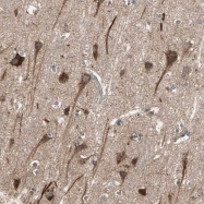 NBP1-84805 - MAPK4 / ERK4