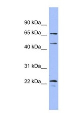 NBP1-58082 - MAPK4 / ERK4